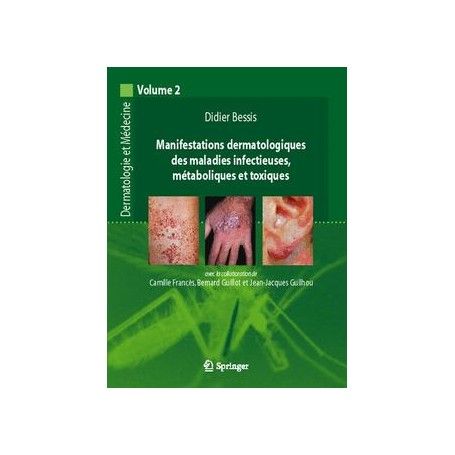 Manifestations dermatologiques des maladies infectieuses, métaboliques et toxiques 