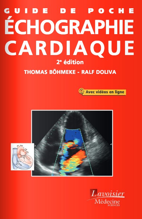 Echographie cardiaque