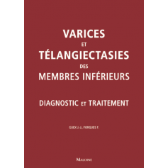 Varices et télangiectasies des membres inférieurs