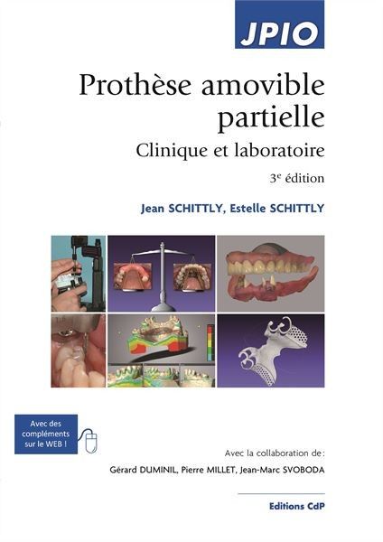 Prothèse amovible partielle