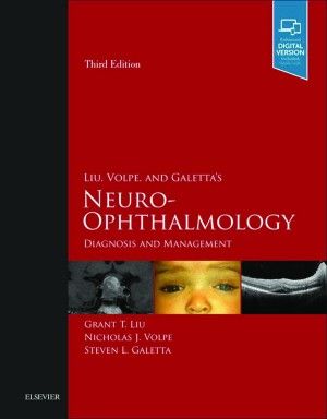 Neuro-ophthalmology