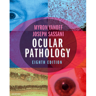 Ocular pathology