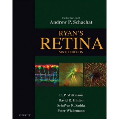 Ryan's retina