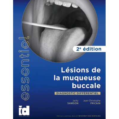 Lésions de la muqueuse buccale