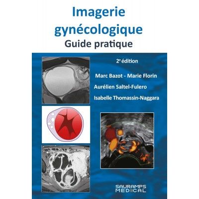 Imagerie gynécologique....
