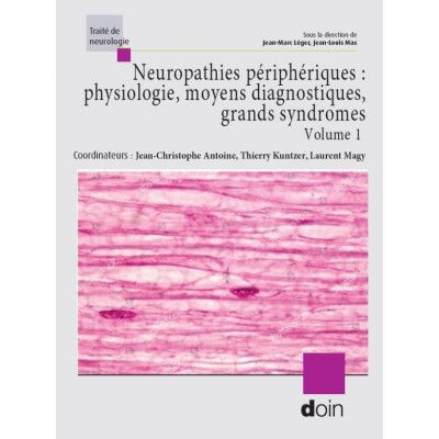 Neurologie   Neuropathies...