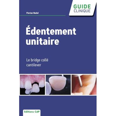 Edentement unitaire - Le...