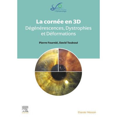 La cornée en 3D -...