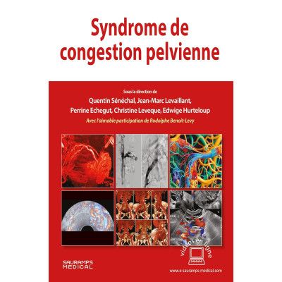 Syndrome de congestion...