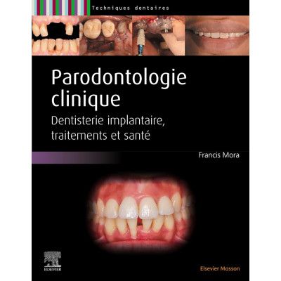 Parodontologie - Maladie...