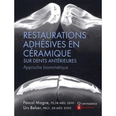 Restauration adhésives en...