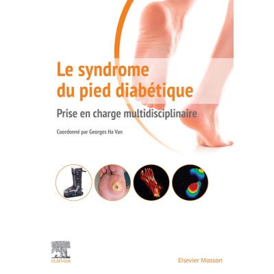 Le syndrome du pied...