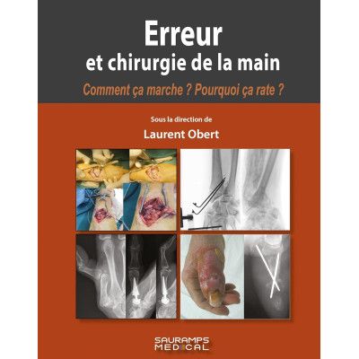 Erreur et Chirurgie de la...