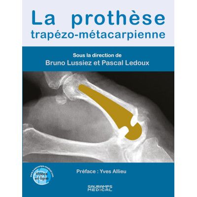 La prothèse...