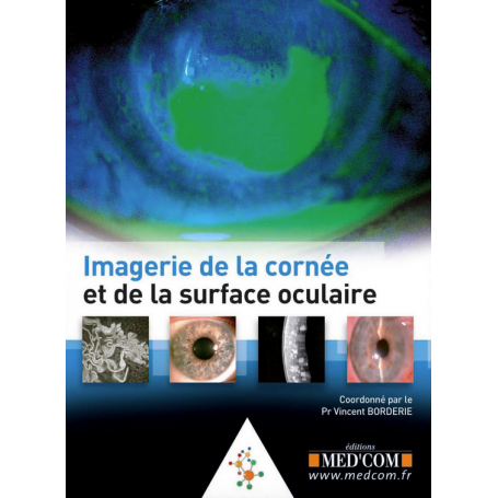 Imagerie de la cornée et de la surface oculaire 