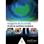 Imagerie de la cornée et de la surface oculaire 