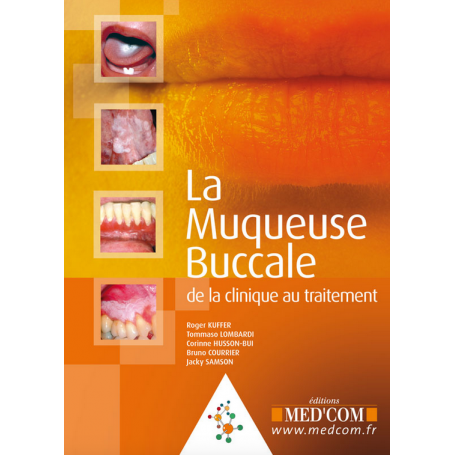 La muqueuse buccale
