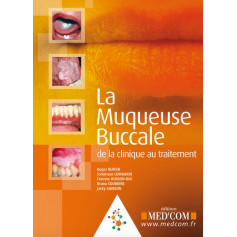 La muqueuse buccale
