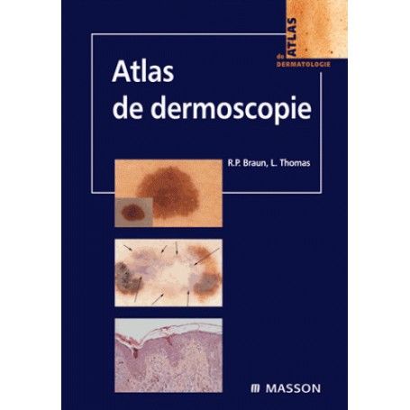 Atlas de dermoscopie