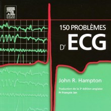 150 problèmes d'ECG