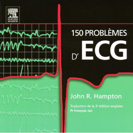 150 problèmes d'ECG
