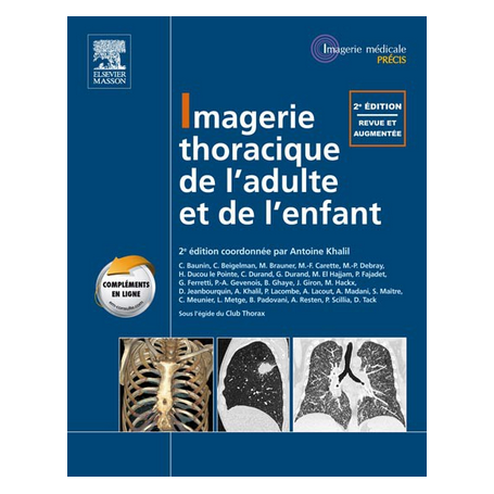 IMAGERIE THORACIQUE DE L'ADULTE ET DE L'ENFANT