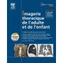 IMAGERIE THORACIQUE DE L'ADULTE ET DE L'ENFANT