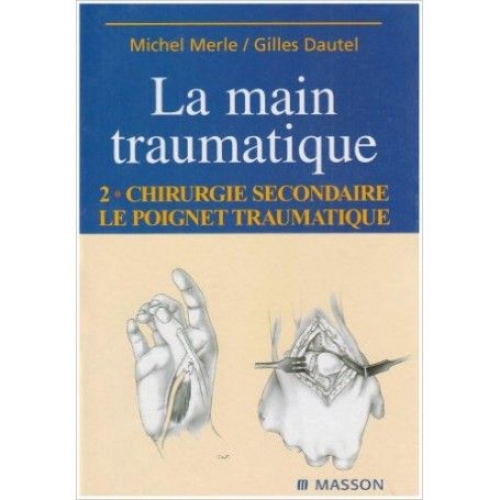 La main traumatique, tome 2 : la main traumatique