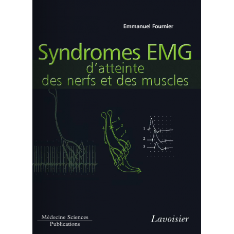 Syndromes EMG d'atteinte des muscles
