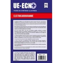 ECG