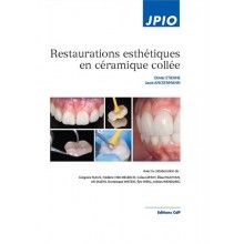 Restaurations esthétiques en céramique colée       