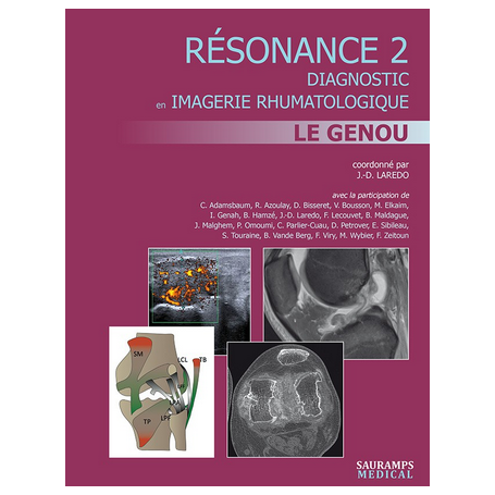 Résonance 2 :  le genou