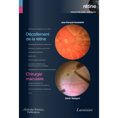 Décollement de la rétine, chirurgie maculaire