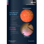Décollement de la rétine, chirurgie maculaire