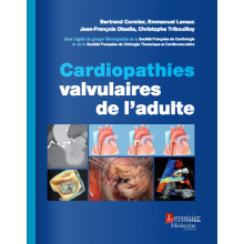 Cardiopathies valvulaires...