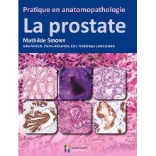 Pratique en anatomopathologie : la prostate