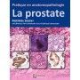 Pratique en anatomopathologie : la prostate