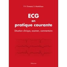 ECG en pratique courante
