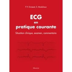 ECG en pratique courante