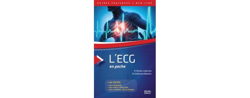 ECG